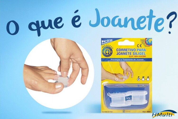 O que é Joanete?