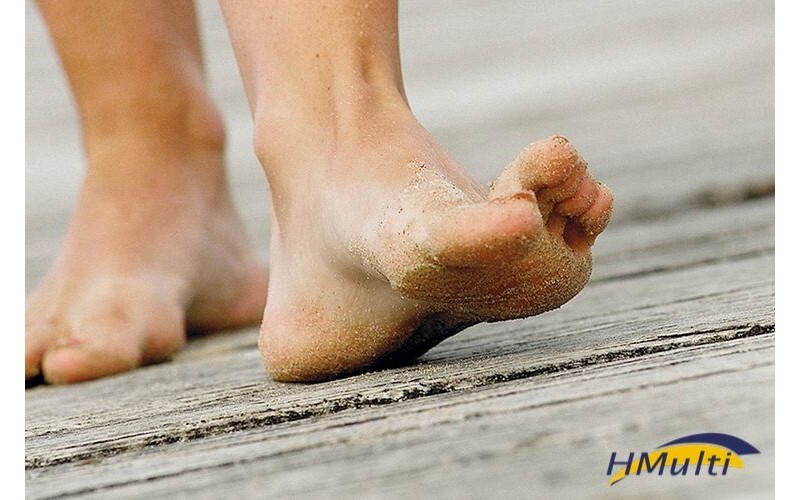 Como o calor afeta seus pés?