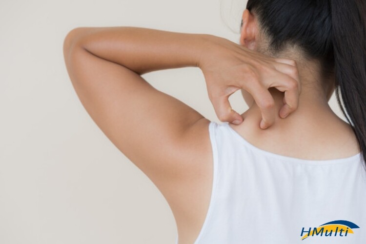 Micose de pele: Conheça as principais causas e sintomas