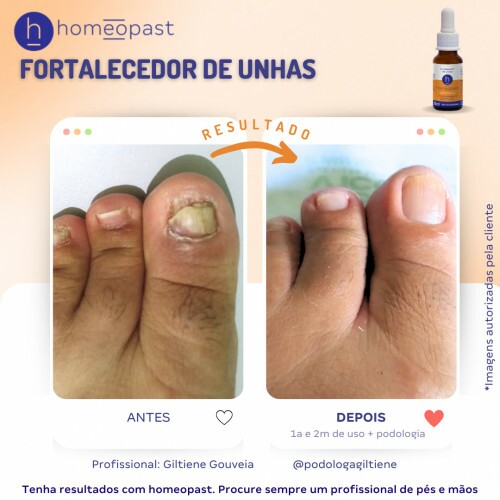 Fortalecedor de Unhas