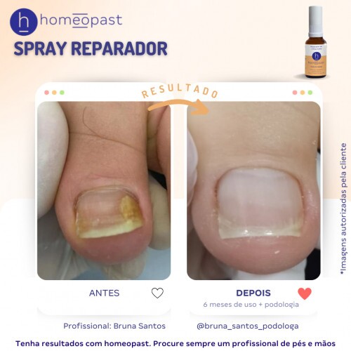 Spray Reparador