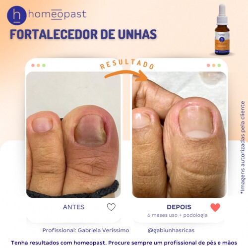 Fortalecedor de Unhas