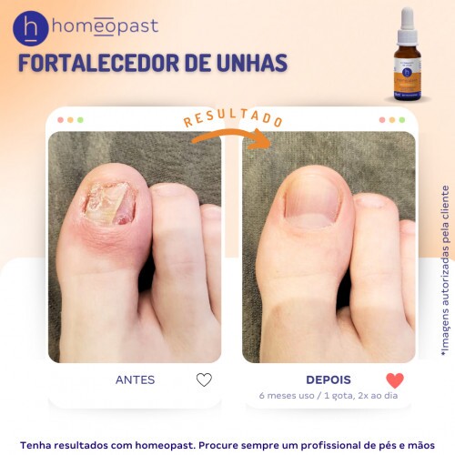 Fortalecedor de Unhas