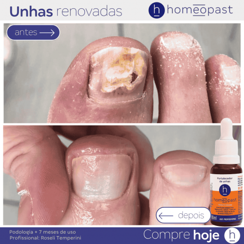 Fortalecedor