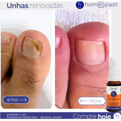 Fortalecedor