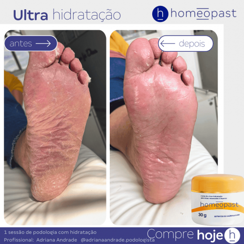 Ultra Hidratação