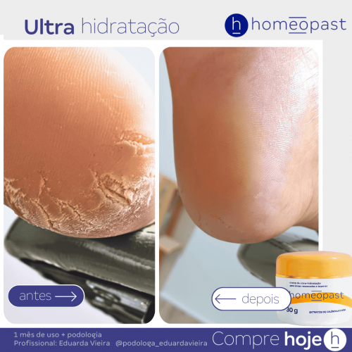 Ultra Hidratação
