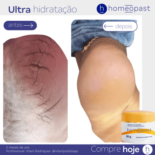 Ultra Hidratação