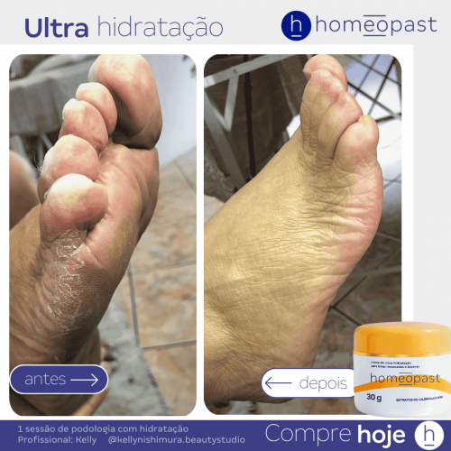 Ultra Hidratação