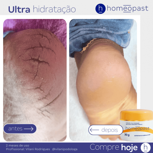 Ultra Hidratação