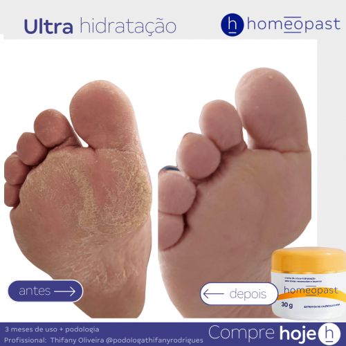 Ultra Hidratação