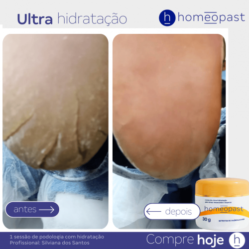 Ultra Hidratação
