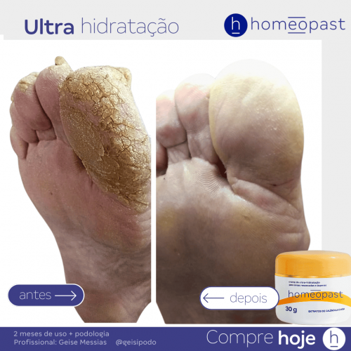 Ultra Hidratação
