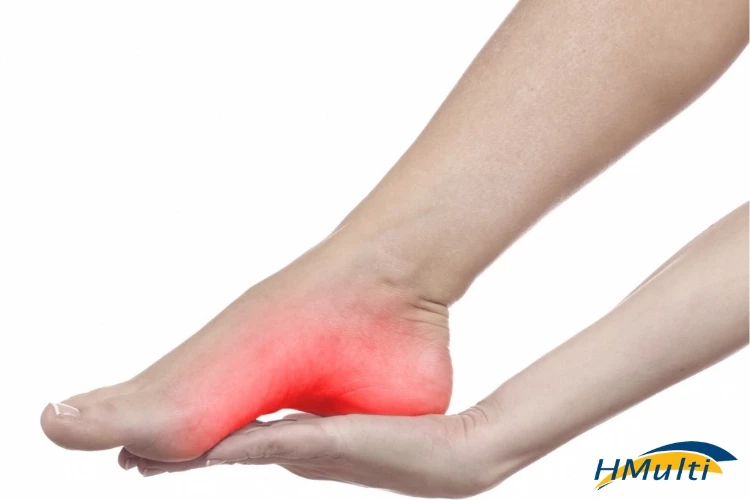 Fascite plantar: Qual relação à dor no calcanhar tem com as suas emoções? Fascite plantar: Qual relação à dor no calcanhar tem com as suas emoções?