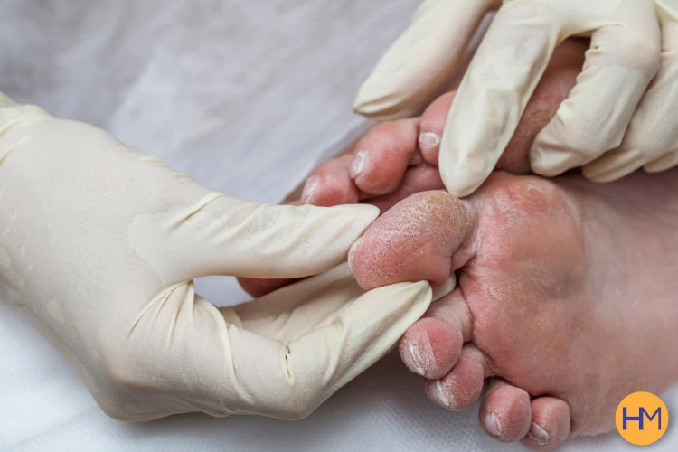 10 Cuidados Essenciais para Pés Diabéticos 10 Cuidados Essenciais para Pés Diabéticos